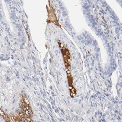 Immunohistochemistry-Paraffin: t-Plasminogen Activator/tPA Antibody [NBP1-87491]