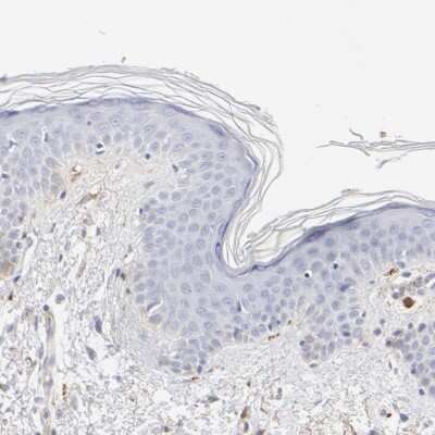 Immunohistochemistry-Paraffin: t-Plasminogen Activator/tPA Antibody [NBP1-87491]
