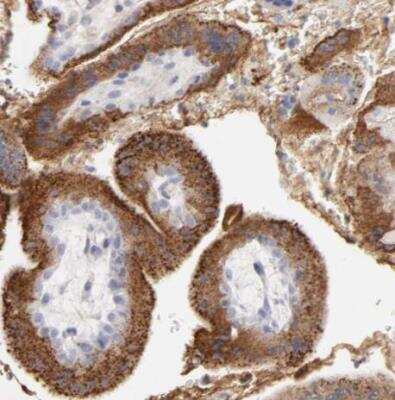 Immunohistochemistry-Paraffin: t-Plasminogen Activator/tPA Antibody [NBP1-87491]