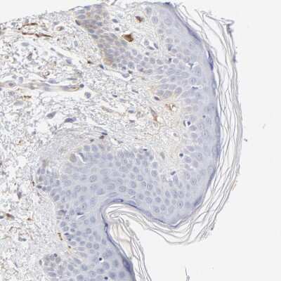 Immunohistochemistry-Paraffin: t-Plasminogen Activator/tPA Antibody [NBP1-87491]