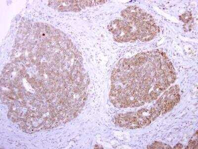 Immunohistochemistry-Paraffin: t-Plasminogen Activator/tPA Antibody [NBP2-20648]