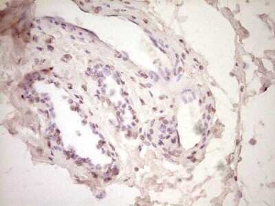 Immunohistochemistry: t-Plasminogen Activator/tPA Antibody (OTI3H3) - Azide and BSA Free [NBP2-74568]