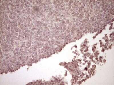Immunohistochemistry: t-Plasminogen Activator/tPA Antibody (OTI3H3) - Azide and BSA Free [NBP2-74568]