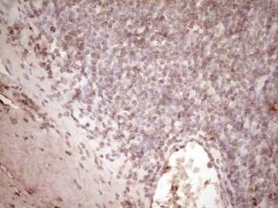Immunohistochemistry: t-Plasminogen Activator/tPA Antibody (OTI3H3) - Azide and BSA Free [NBP2-74568]