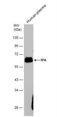 Western Blot: t-Plasminogen Activator/tPA Antibody [NBP2-20648]
