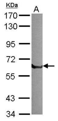 Western Blot: t-Plasminogen Activator/tPA Antibody [NBP2-20648]