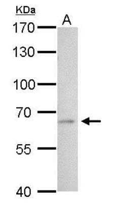 Western Blot: t-Plasminogen Activator/tPA Antibody [NBP2-20648]