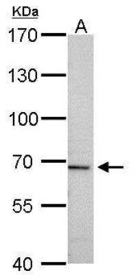 Western Blot: t-Plasminogen Activator/tPA Antibody [NBP2-20648]