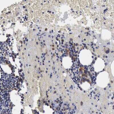 Immunohistochemistry-Paraffin: taxilin gamma Antibody [NBP1-90605]