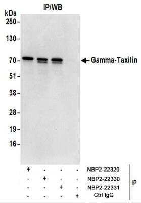 Immunoprecipitation: taxilin gamma Antibody [NBP2-22331]