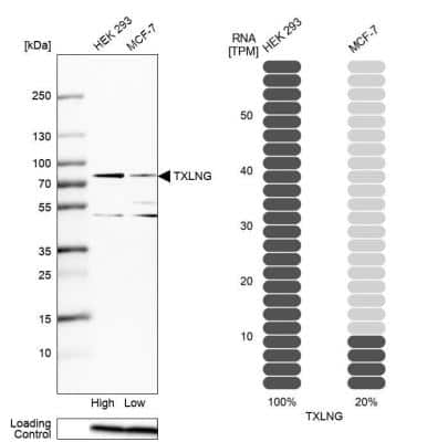 Western Blot: taxilin gamma Antibody [NBP1-90606]