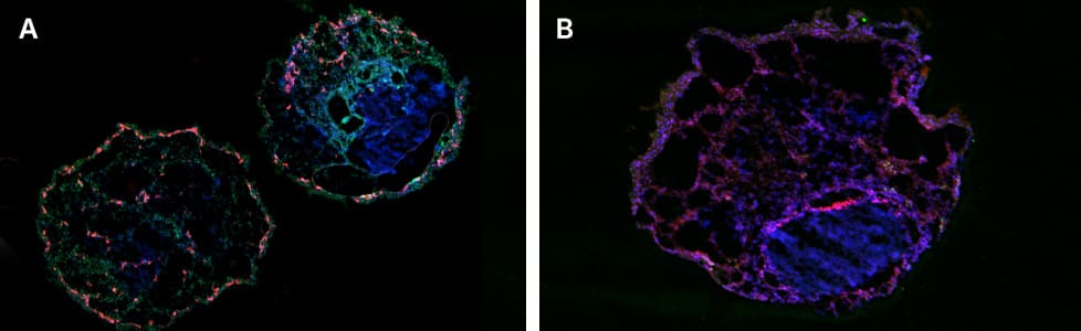 Heart organoids formed from iPSCs using CHIR 99021