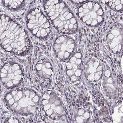 Immunohistochemistry-Paraffin: tescalcin Antibody [NBP2-13426]