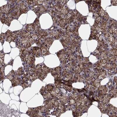Immunohistochemistry-Paraffin: tescalcin Antibody [NBP2-13426]