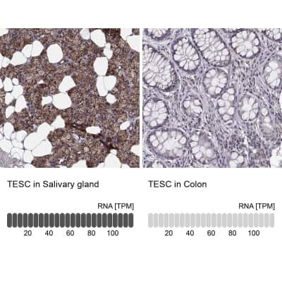 Immunohistochemistry-Paraffin: tescalcin Antibody [NBP2-13426]