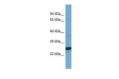 Western Blot: tescalcin Antibody [NBP2-83640]