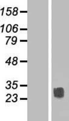 Western Blot: tetraspanin 14 Overexpression Lysate [NBP2-06157]