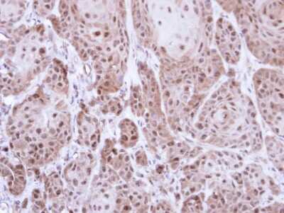 Immunohistochemistry-Paraffin: Thioredoxin Reductase 1/TRXR1 Antibody [NBP2-20619]