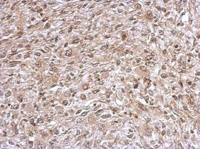 Immunohistochemistry-Paraffin: Thioredoxin Reductase 1/TRXR1 Antibody [NBP2-20620]