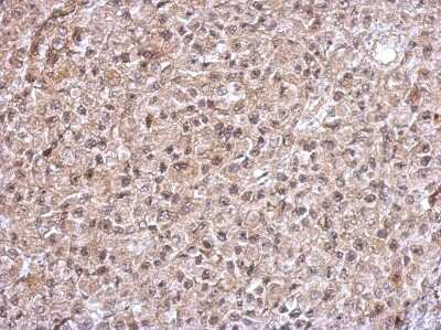 Immunohistochemistry-Paraffin: Thioredoxin Reductase 1/TRXR1 Antibody [NBP2-20620]