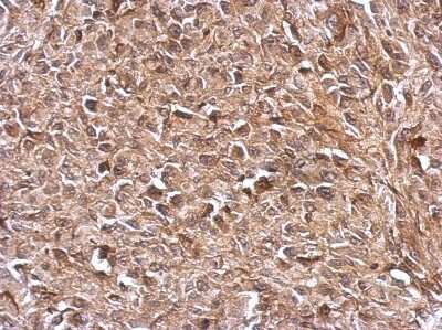 Immunohistochemistry-Paraffin: Thioredoxin Reductase 1/TRXR1 Antibody [NBP2-20620]