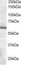 Western Blot: Thioredoxin Reductase 1/TRXR1 Antibody [NB300-879]