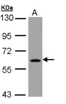 Western Blot: Thioredoxin Reductase 1/TRXR1 Antibody [NBP2-20619]