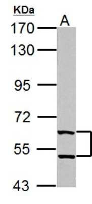Western Blot: Thioredoxin Reductase 1/TRXR1 Antibody [NBP2-20619]
