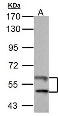 Western Blot: Thioredoxin Reductase 1/TRXR1 Antibody [NBP2-20619]