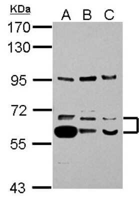 Western Blot: Thioredoxin Reductase 1/TRXR1 Antibody [NBP2-20620]