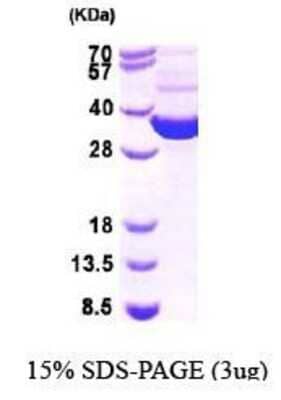 SDS-PAGE: Recombinant E. coli Thioredoxin Reductase 1/TRXR1 Protein [NBP1-44981]