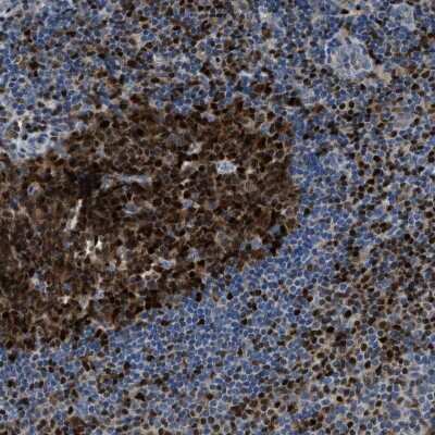 Immunohistochemistry-Paraffin: TOX Antibody [NBP1-87857]