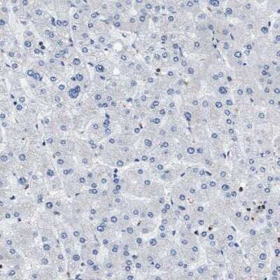 Immunohistochemistry-Paraffin: TOX Antibody [NBP1-87857]