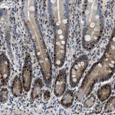 Immunohistochemistry-Paraffin: TOX Antibody [NBP1-87857]