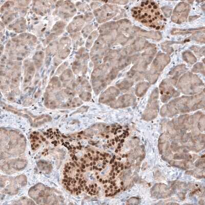 Immunohistochemistry-Paraffin: TOX Antibody [NBP1-87857]