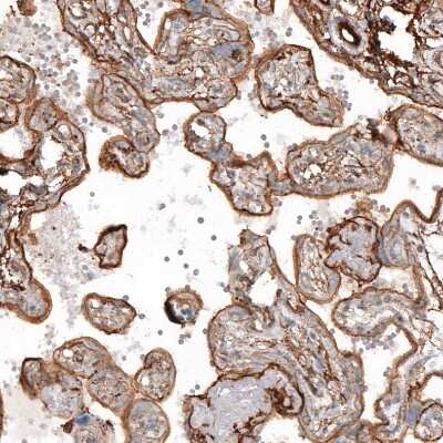 Immunohistochemistry-Paraffin: transgelin 2 Antibody [NBP1-89722]