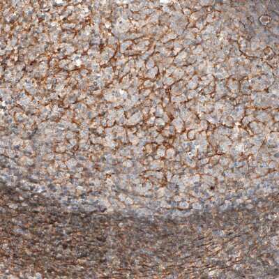 Immunohistochemistry-Paraffin: transgelin 2 Antibody [NBP1-89722]