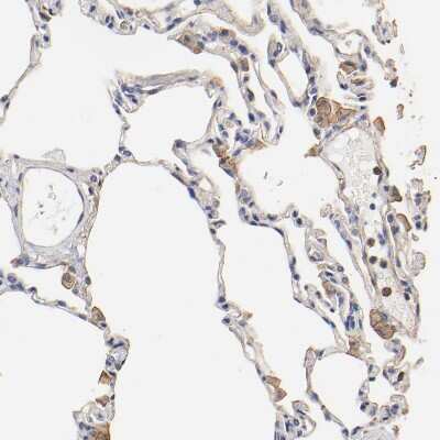 Immunohistochemistry-Paraffin: transgelin 2 Antibody [NBP1-89722]