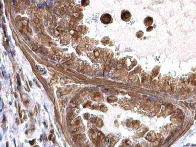 Immunohistochemistry-Paraffin: transgelin 2 Antibody [NBP2-20697]