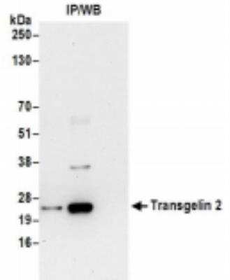Immunoprecipitation: transgelin 2 Antibody [NBP2-36550]