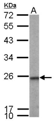 Western Blot: transgelin 2 Antibody [NBP2-20697]
