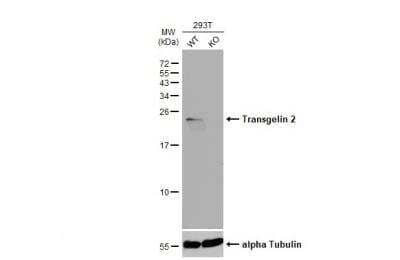 Western Blot: transgelin 2 Antibody [NBP2-20697]