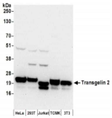 Western Blot: transgelin 2 Antibody [NBP2-36550]