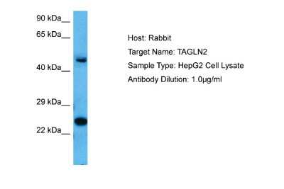 Western Blot: transgelin 2 Antibody [NBP2-88459]