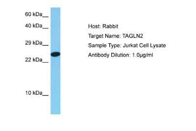 Western Blot: transgelin 2 Antibody [NBP2-88461]