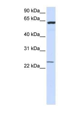 Western Blot: TMEM 138 Antibody [NBP1-59523]