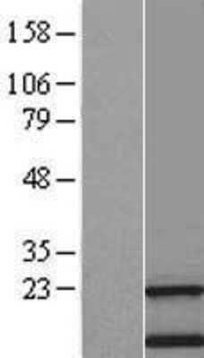 Western Blot: TMEM 138 Overexpression Lysate [NBL1-17012]