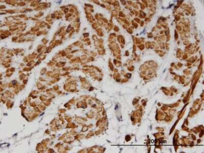 Immunohistochemistry-Paraffin: tropomyosin-2 Antibody (3C8) [H00007169-M07]