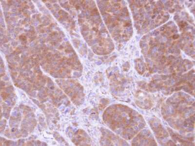 Immunohistochemistry-Paraffin: tropomyosin-2 Antibody [NBP1-32770]