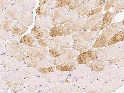 Immunohistochemistry-Paraffin: tropomyosin-2 Antibody [NBP2-99519]